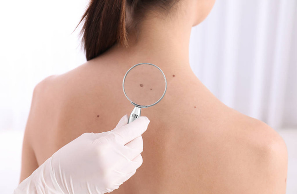 Dermatologe untersucht Patientin mit Lupe in Klinik, Nahaufnahme - Foto, Bild