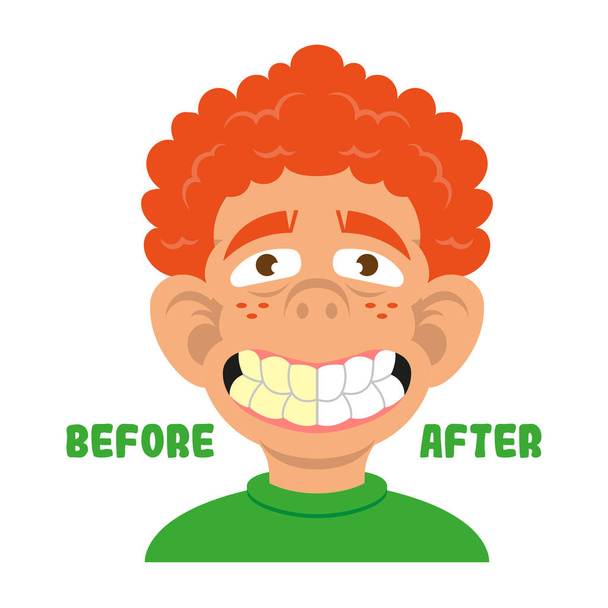 Menino mostrar dentes antes e depois de limpo
  - Vetor, Imagem