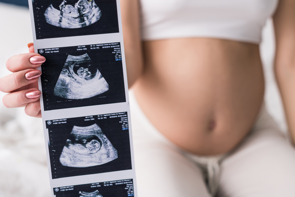 Vista recortada de la mujer embarazada que muestra ecografías
 - Foto, imagen