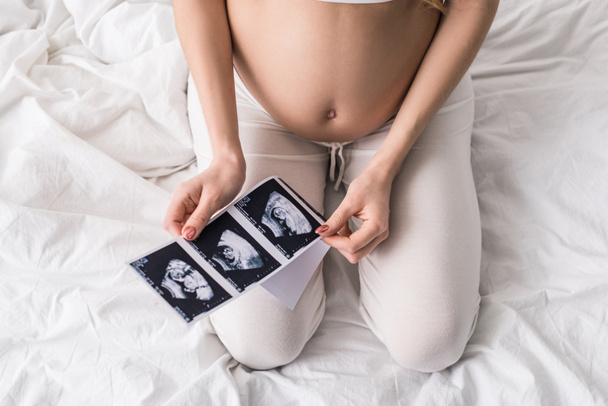 Vista parcial da mulher grávida sentada na cama com ultra-som
 - Foto, Imagem