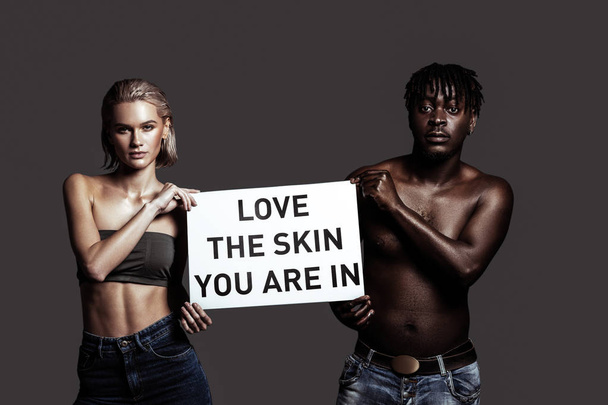 Couple of international models supporting their skin color - Zdjęcie, obraz
