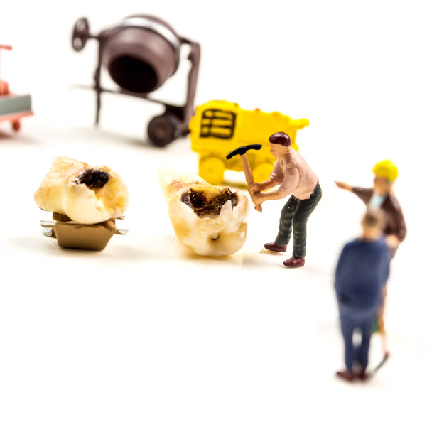 pieni miniatyyri hahmoja työntekijöiden vahvistamisesta ongelma iso karieksen maitohampaan poskihammas työskentelemällä kuljetus ongelmallinen hammas pois valkoisella pohjalla
 - Valokuva, kuva