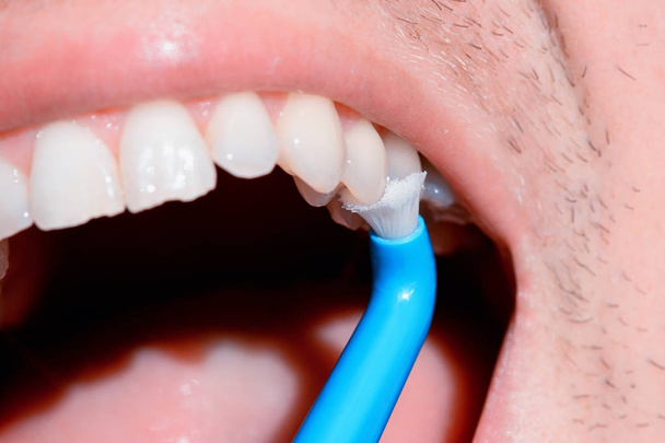 Οδοντιατρική υγιεινολόγος εξέταση των δοντιών του ασθενούς στον οδοντίατρο. - Φωτογραφία, εικόνα