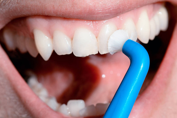 歯科衛生士が歯科医に患者の歯を調べること. - 写真・画像