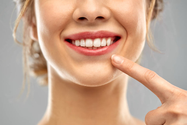 Close up van woman wijzend naar haar witte tanden - Foto, afbeelding