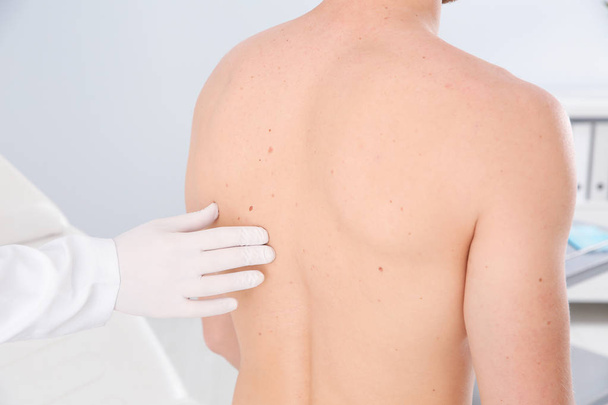 Dermatologist examining patient's birthmark in clinic, closeup - Фото, зображення