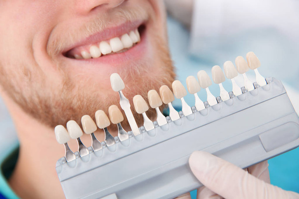 Dentist selecting patient's teeth color with palette in clinic, closeup - Fotó, kép