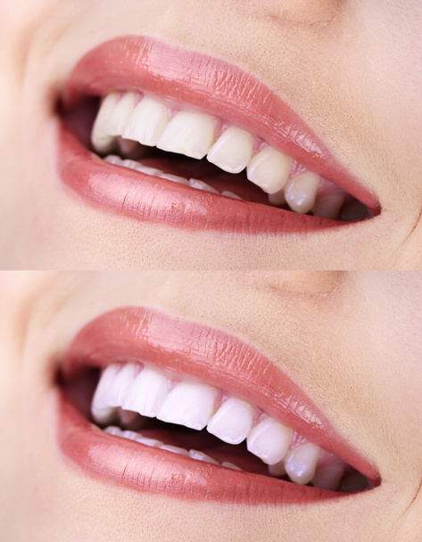 γυναίκα που είναι χαμογελώντας με δόντια close-up - Φωτογραφία, εικόνα