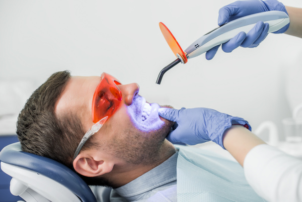 vista recortada del dentista haciendo procedimiento de blanqueamiento para el paciente
  - Foto, Imagen