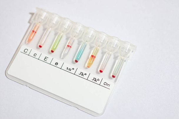 Bloedgroep Rh tpyping testen gel test. - Foto, afbeelding