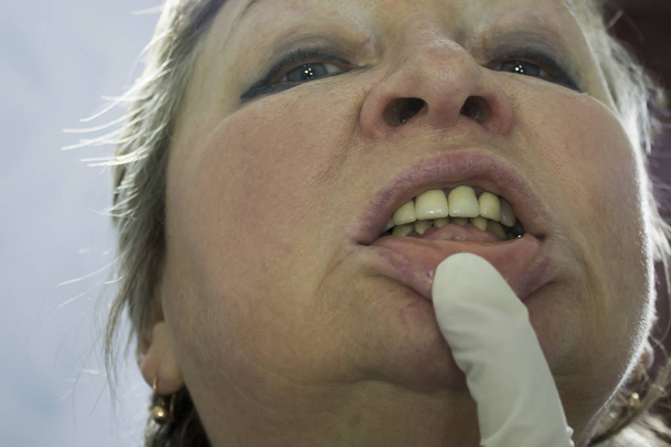 Глубокий укус Рука доктора задерживает женскую нижнюю губу
.  - Фото, изображение
