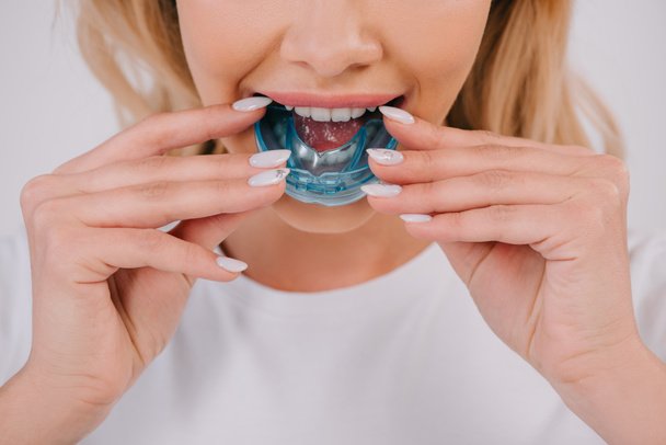 cropped view of woman putting on orthodontic trainer dental braces isolated on white - Zdjęcie, obraz