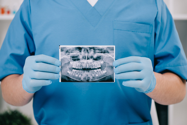 cropped view of orthodontist holding teeth x-ray in clinic - Φωτογραφία, εικόνα