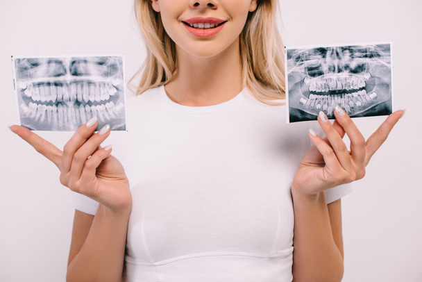 vista recortada de la mujer sonriente en camiseta sosteniendo los dientes rayos X aislados en blanco
 - Foto, Imagen