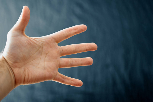 Mão adulta com Síndrome de Raynaud Fenômeno. Fechar a mão com os dedos no fundo escuro com espaço de cópia
 - Foto, Imagem