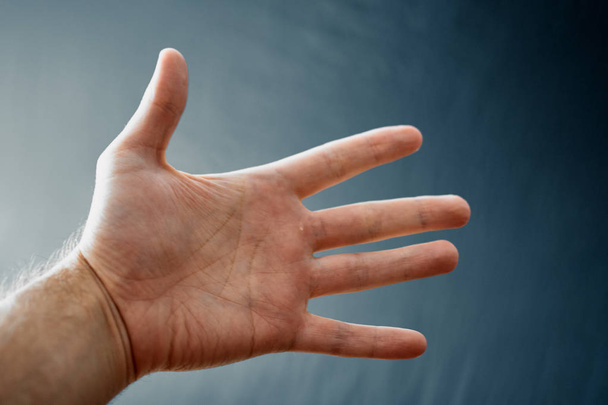 Mão adulta com Síndrome de Raynaud Fenômeno. Fechar a mão com os dedos no fundo escuro com espaço de cópia
 - Foto, Imagem