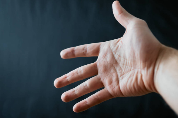 Volwassen hand met syndroom van Raynaud - fenomeen. Close-up van de hand met de vingers op een donkere achtergrond met kopie ruimte - Foto, afbeelding