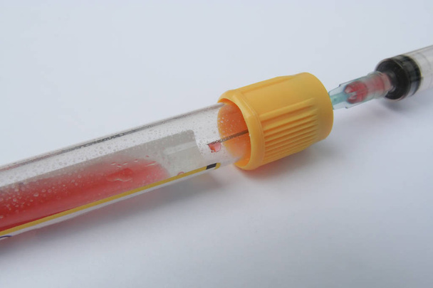 Blood sample in a test tube. Laboratory test tube filled with human blood sample. - Fotó, kép