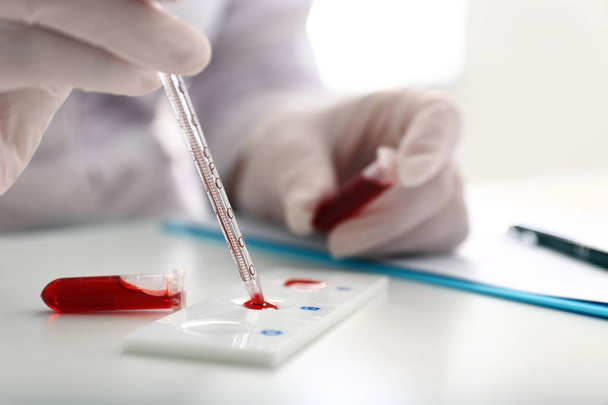 Женщина работает с образцом крови в лаборатории, крупным планом
 - Фото, изображение