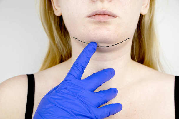 Podbródka: plastikowe podbródek. Pacjent przed operacją podbródka i szyi. Chirurg plastyczny radzi - Zdjęcie, obraz