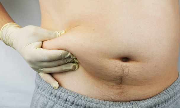 Un médico examina a un hombre, un dispositivo médico. El concepto de obesidad y obesidad
 - Foto, Imagen