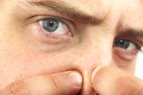 Detailní portrét mladý muž při pohledu na fotoaparát, mačkání akné a černé tečky na nose. Detail jako zázemí pro hygienu obličeje a nosu. Dermatologie a kožní problémy. Mastná pleť obličeje - Fotografie, Obrázek