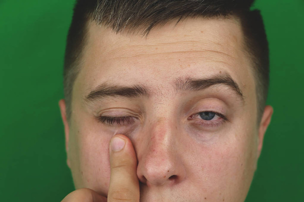 Tears in eyes of crying adult man. Green background. Chromakey - Photo, Image