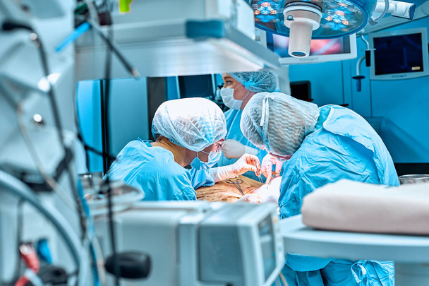 Χειρουργοί ομάδα εργασίας στο νοσοκομείο, λειτουργούν δωμάτιο - Φωτογραφία, εικόνα