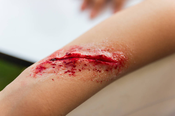 Фальшивые раны на руках детей одевают рану спецэффектом
 - Фото, изображение