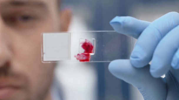 vista cortada do cientista olhando para amostra de sangue em vidro em laboratório
 - Filmagem, Vídeo