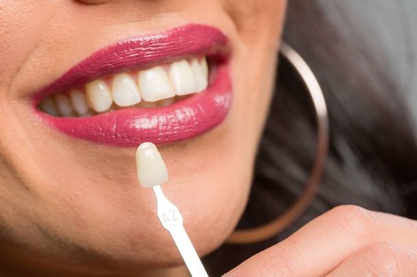 Za pomocą Przewodnik odcień w ustach kobiety aby sprawdzić okleina korony zęba - Zdjęcie, obraz
