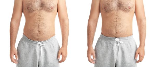 Overweight man before and after weight loss on white background, closeup - Foto, immagini