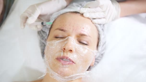 Косметолог проводит косметическую процедуру мезотерапии лица, делая инъекции в лоб клиента в косметологической клинике
. - Кадры, видео
