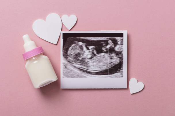 Baby scan ultrasound picture. Expectant parents concept - Fotoğraf, Görsel