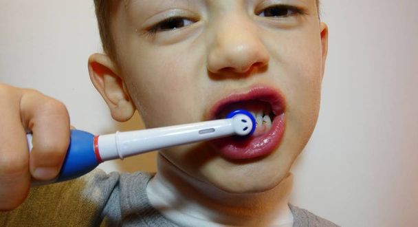 Karies bei Kindern. Schlechter Zahn. Reinigung der Mundhöhle - Foto, Bild