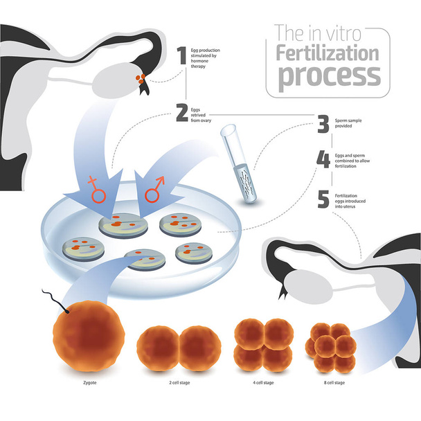 Conceito de ilustração vetorial de fertilização in vitro. Colorido sobre fundo branco
 - Vetor, Imagem
