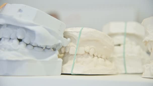 Dental gips model cast van menselijke tandheelkundige kaak. Laboratorium protheses. Close-up - Video