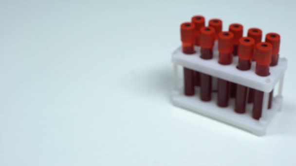 Negative C diphtheriae test, doctor showing blood sample lab research healthcare - Filmagem, Vídeo