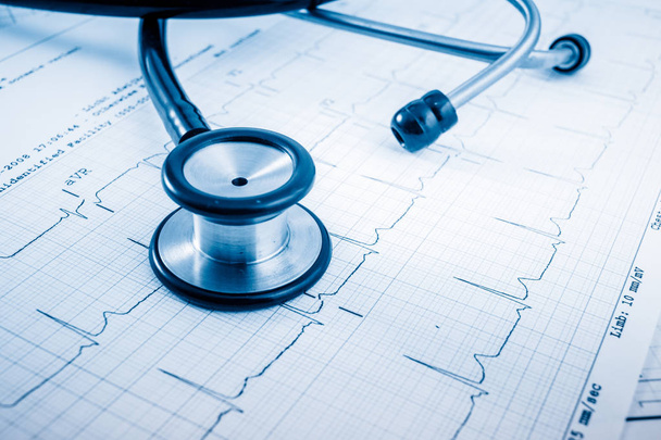 Stethoscope on cardiogram concept for heart care on the desk.blue toned images. - Foto, Imagem