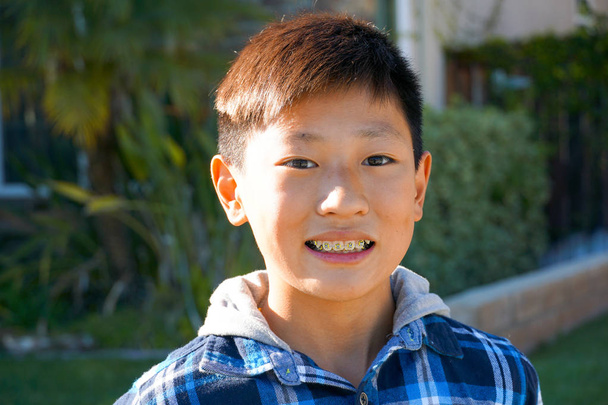 Πορτραίτο του ο νεαρός Ασίας αγόρι με σιδεράκια δοντιών. Νέοι έφηβος αγόρι χαμογελώντας και δείχνοντας του ορθοδοντικά σιδεράκια για τα δόντια του. - Φωτογραφία, εικόνα