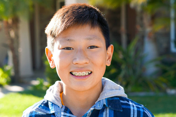 Portrét mladého kluka asijské chlapce s zubní rovnátka. Mladý dospívající chlapec s úsměvem a ukazuje jeho ortodontická rovnátka na zuby. - Fotografie, Obrázek