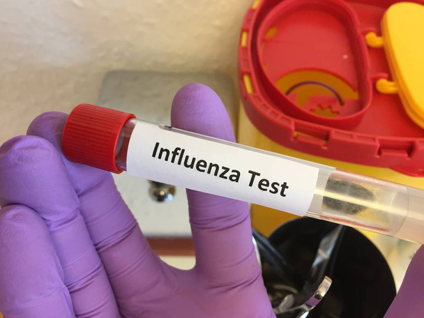 Blood test tube for Influenza virus testing - Photo, Image