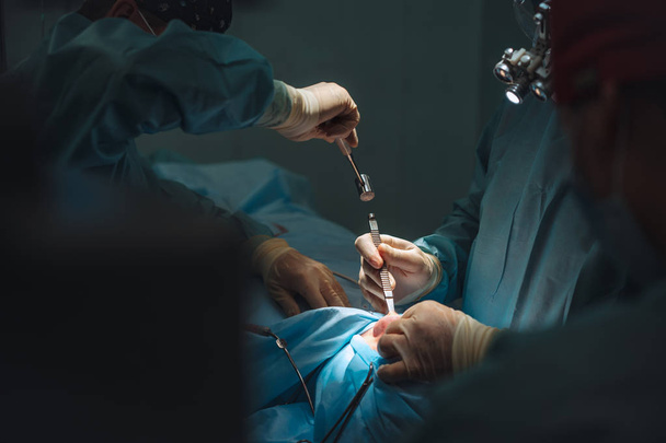 Хірург використовує стамеску і молоток
 - Фото, зображення