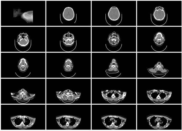 ct scan ensemble de pas de cou supérieur vue axiale supérieure
 - Photo, image