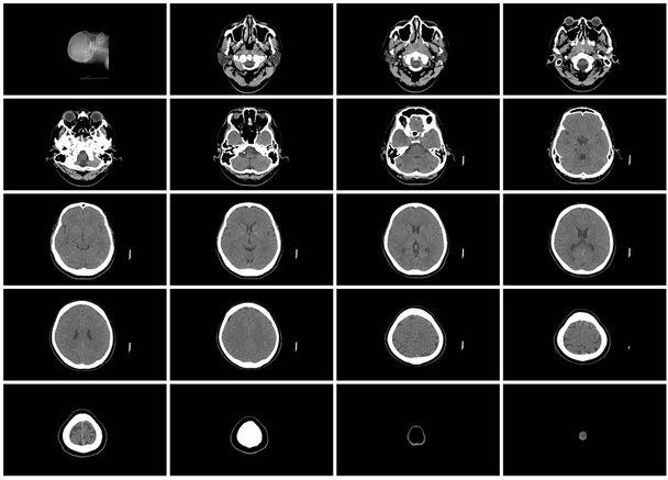ct set di passaggi di scansione della vista assiale superiore della testa cerebrale
 - Foto, immagini
