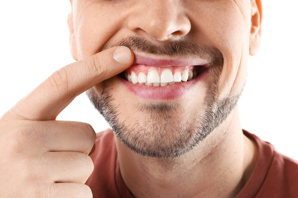 Smiling man showing teeth on white background, closeup - 写真・画像