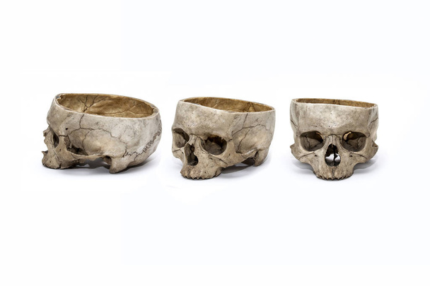 Emberi koponya három pozíció - Fotó, kép