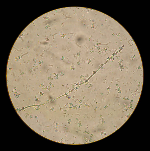 vista microscópica de los hongos candida albicans en la preparación nativa
 - Foto, imagen