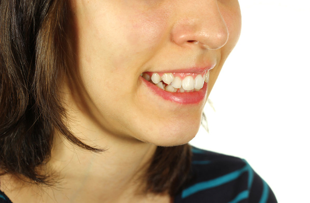 Crooked teeth - Fotó, kép