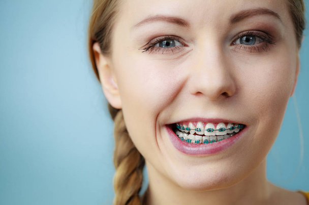 Primer plano de dientes de mujer con frenos, cara divertida
 - Foto, Imagen